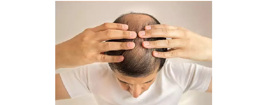 Ayurvedic remedies for hair loss and regrowth