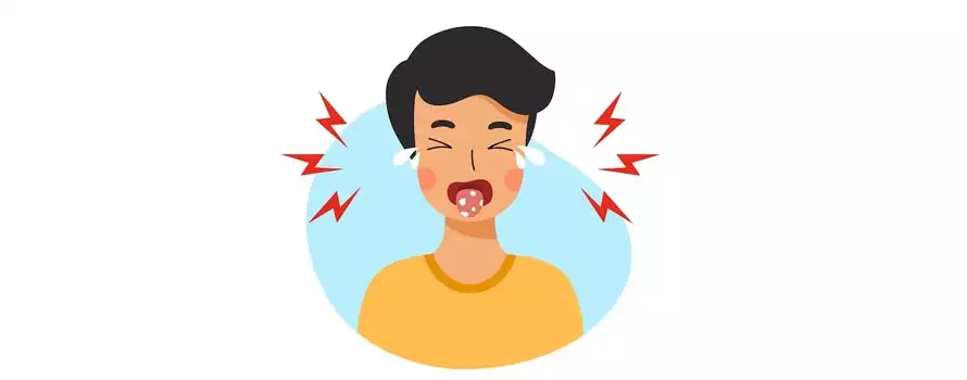 5 Ayurvedic Remedies To Treat Tongue Burn 1