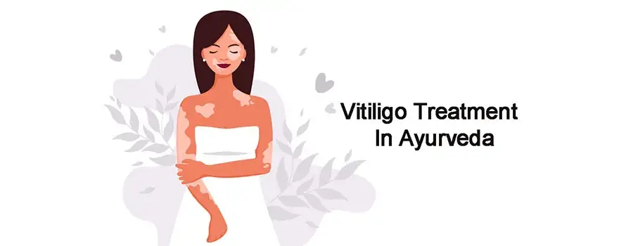 Vitiligo Treatment In Ayurveda 1